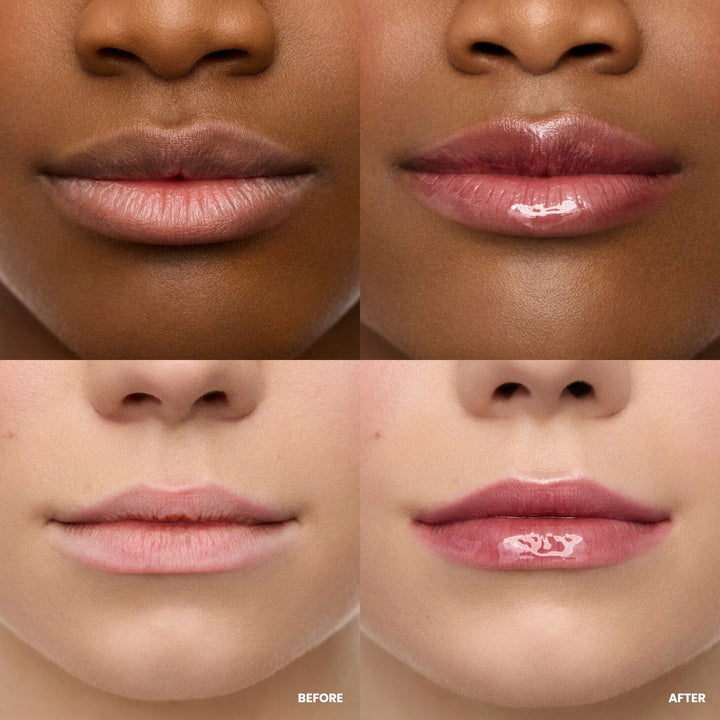 Wonderskin - Lip Rehab Serum Oil - Honey WS-LO-HNE - Honey Læbepleje 