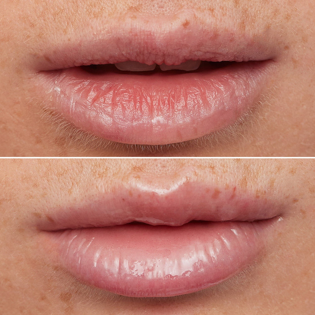Wonderskin - Lip Rehab Therapy Oil - Clear - Læbepleje 